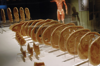 Slices of a human body are displayed to show the inner workings of a human body.